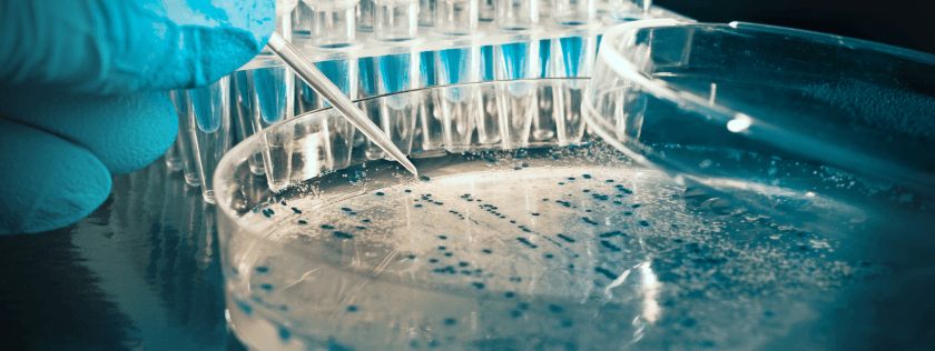 Testing for bacteria in lab