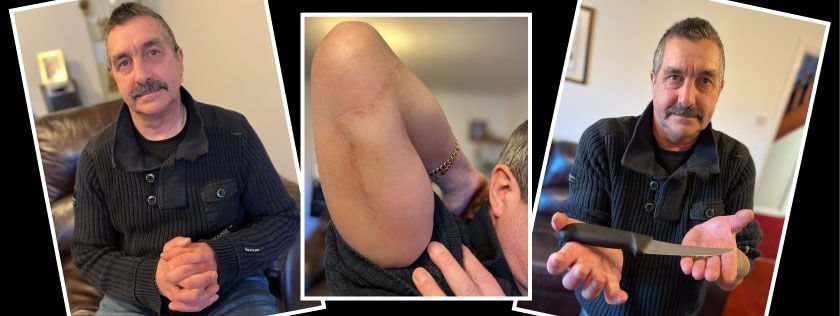 Butcher injured at work after colleague accidentally stabs him in the arm