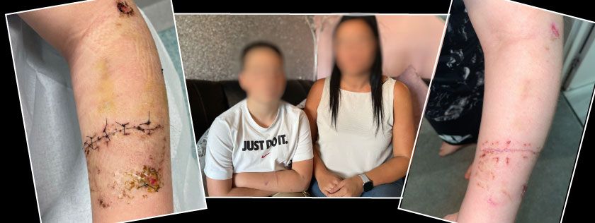 Schoolboy scarred for life after Rottweiler attack