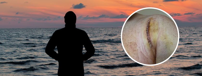 Offshore worker with career-ending shoulder injury secures life-changing compensation