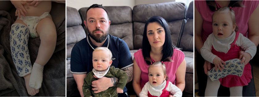 Family seeks legal help after baby suffers broken leg on first day of nursery