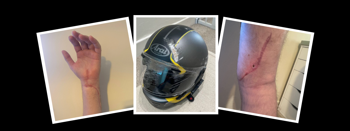 Pictures of an injury to the wrist and leg of Barry Evans, along with a picture of his motorcycle helmet with severe srapes