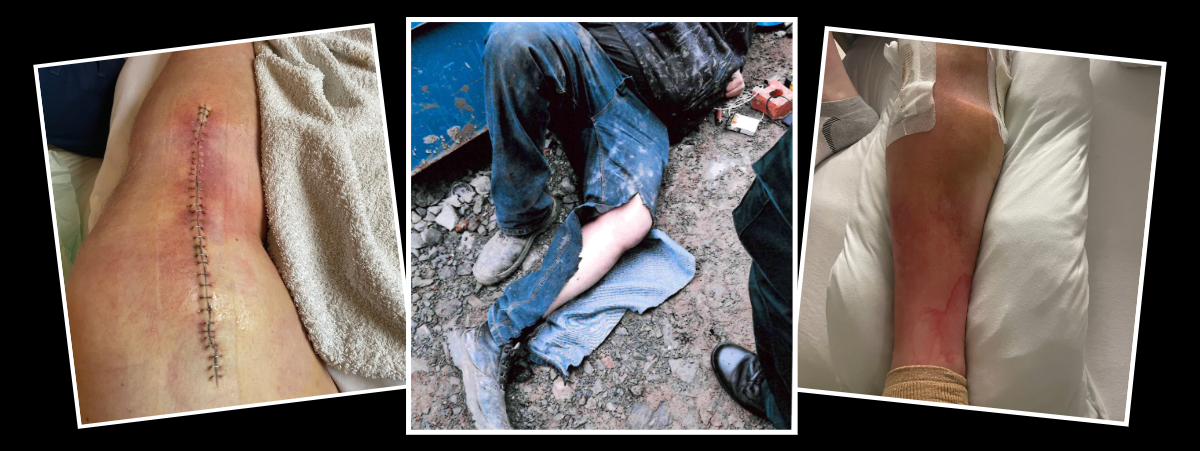 Three images depicting John's injuries.