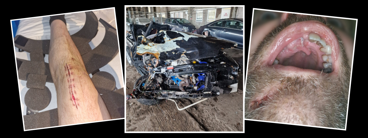 Robert Cruickshank suffered life-changing injuries in a car crash