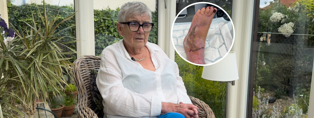 Image shows Anne sitting on a chair in her conservatory - there is an image overlayed to the right of her foot showing bruising and cuts after her fall.