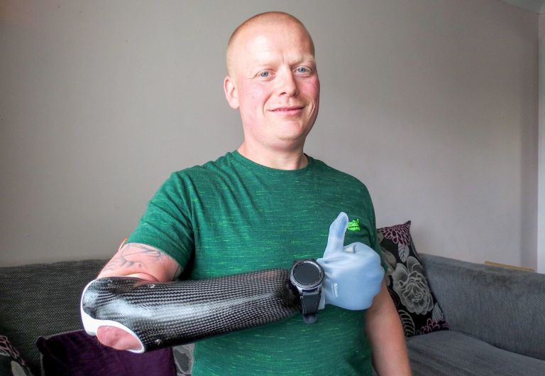 Ian McDonald, a firefighter with prosthetic arm holding his thumb up