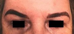 Semi Permanent Makeup Brow Injury - Client E