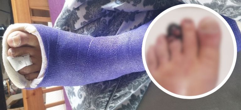 Woman crushed by Land Rover gets £125,000 - after insurers tried to “fob her off” with just £5k