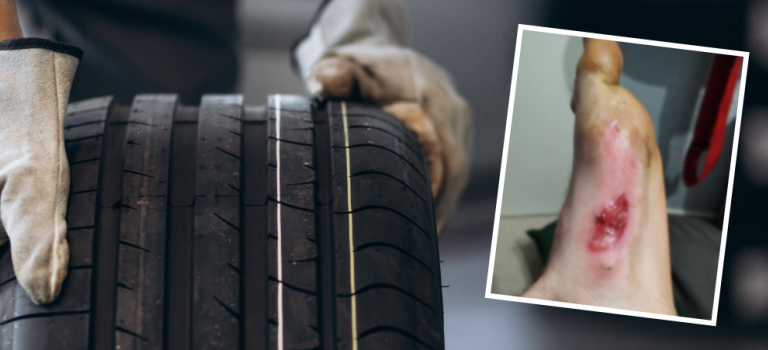 Image of gloved hands rolling a car tyre. There is a picture overlayed of a foot with burn marks.