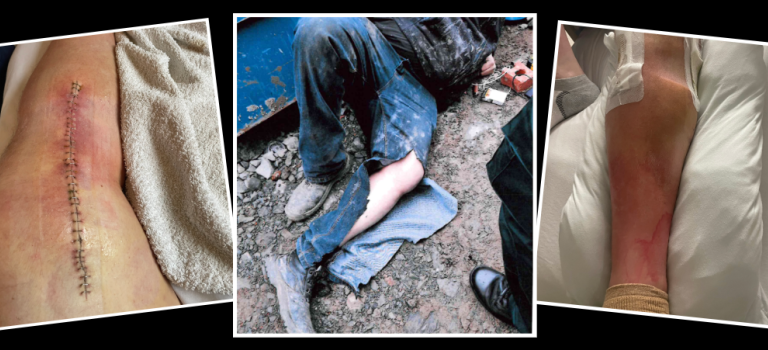 Three images depicting John's injuries.