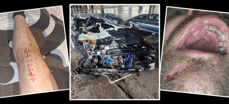 Robert Cruickshank suffered life-changing injuries in a car crash