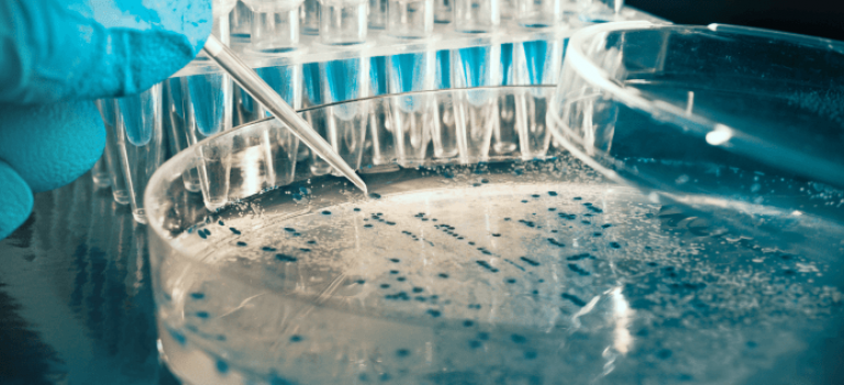Testing for bacteria in lab