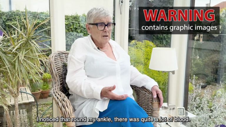 Anne talking about her personal injury